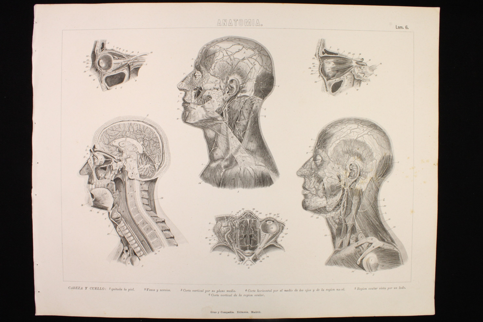 Antiques - ENGRAVING ANATOMY PLATE 6. GRAS AND Cª. 1885. HEAD AND NECK.