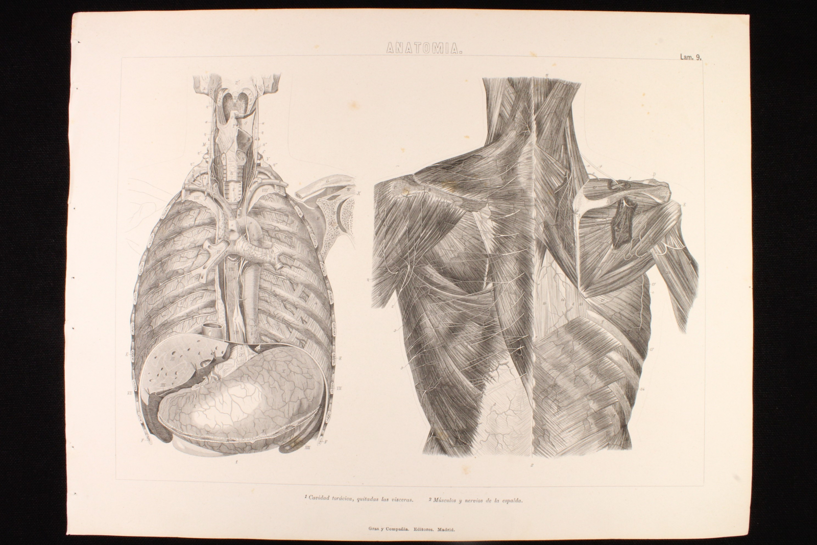 Antiguedades - GRABADO ANATOMÍA LÁMINA 9. GRAS Y Cª. 1885. CAVIDAD TORÁCICA. MÚSCULOS