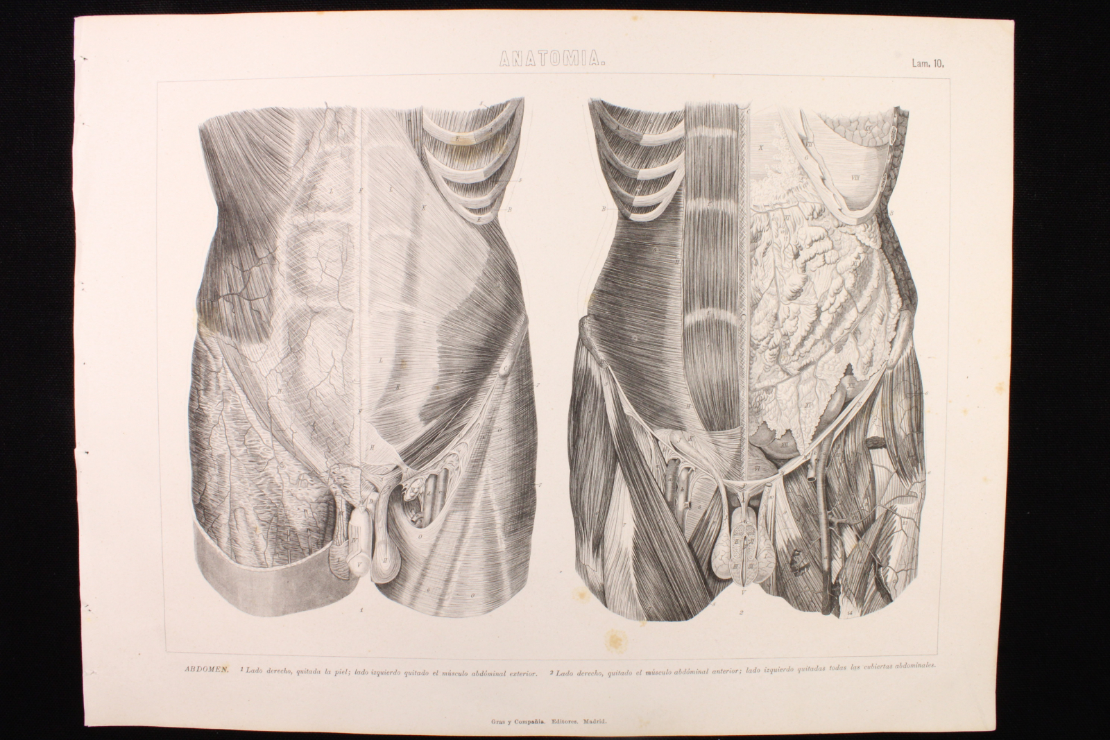 Antiguedades - GRABADO ANATOMÍA LÁMINA 10. GRAS Y Cª. 1885. ABDOMEN.