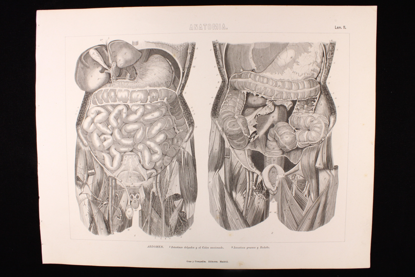 Antiques - ENGRAVING ANATOMY PLATE 11. GRAS AND Cª. 1885. ABDOMEN. INTESTINES.