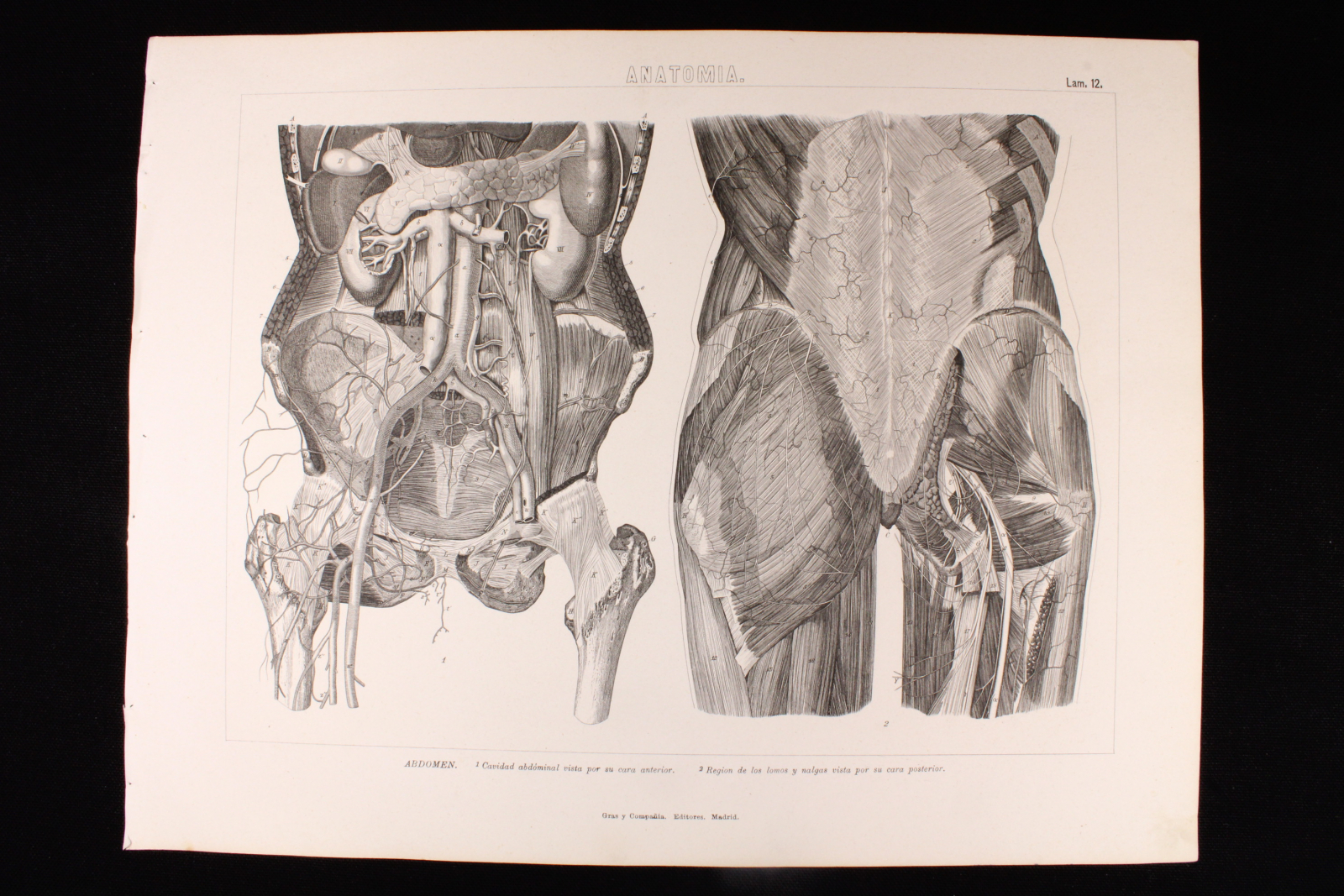 Antiques - ENGRAVING ANATOMY PLATE 12. GRAS AND Cª. 1885. ABDOMEN ABDOMINAL CAVIT