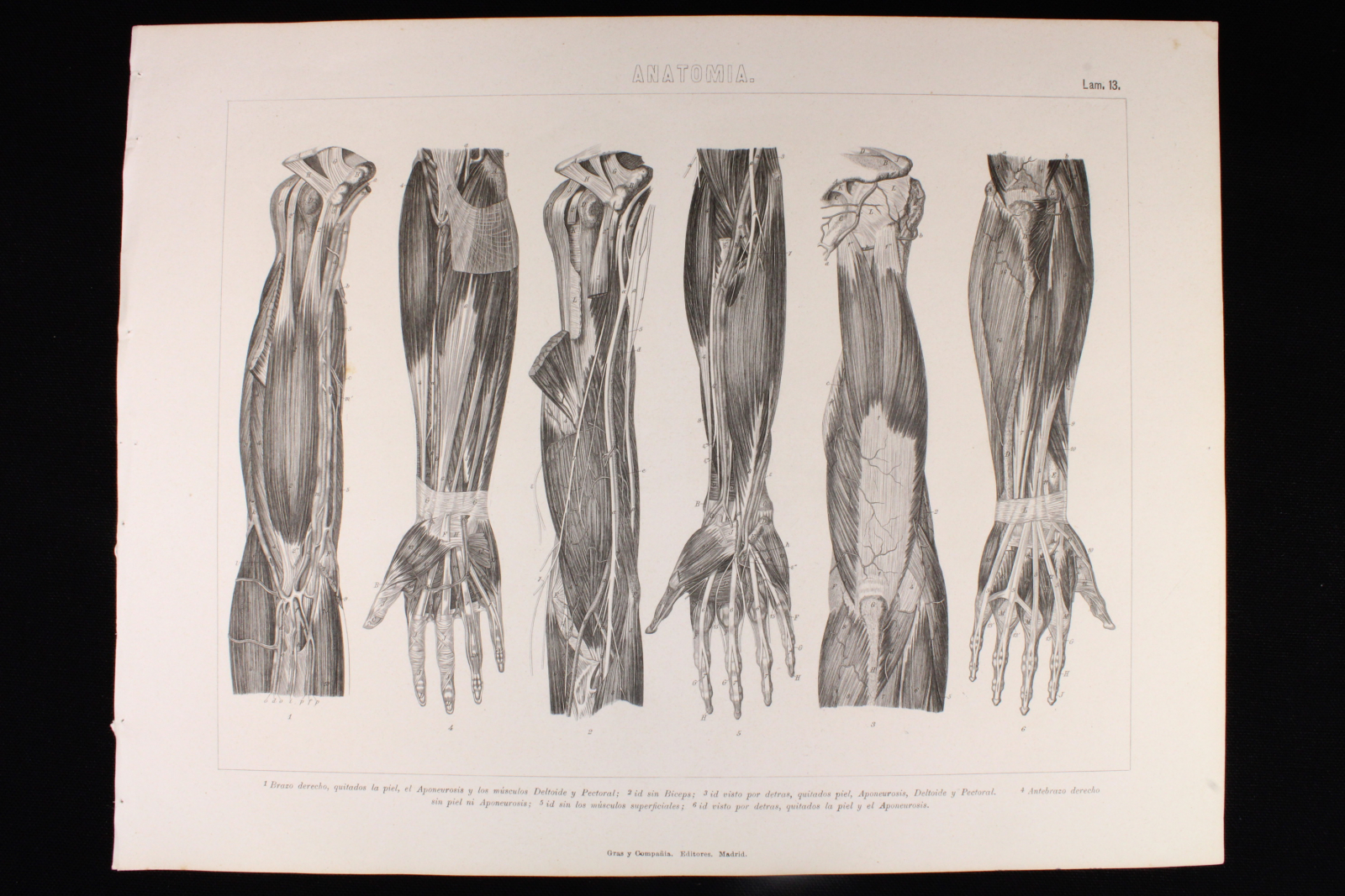 Antiguedades - GRABADO ANATOMÍA LÁMINA 13. GRAS Y Cª. 1885. BRAZO, ANTEBRAZO