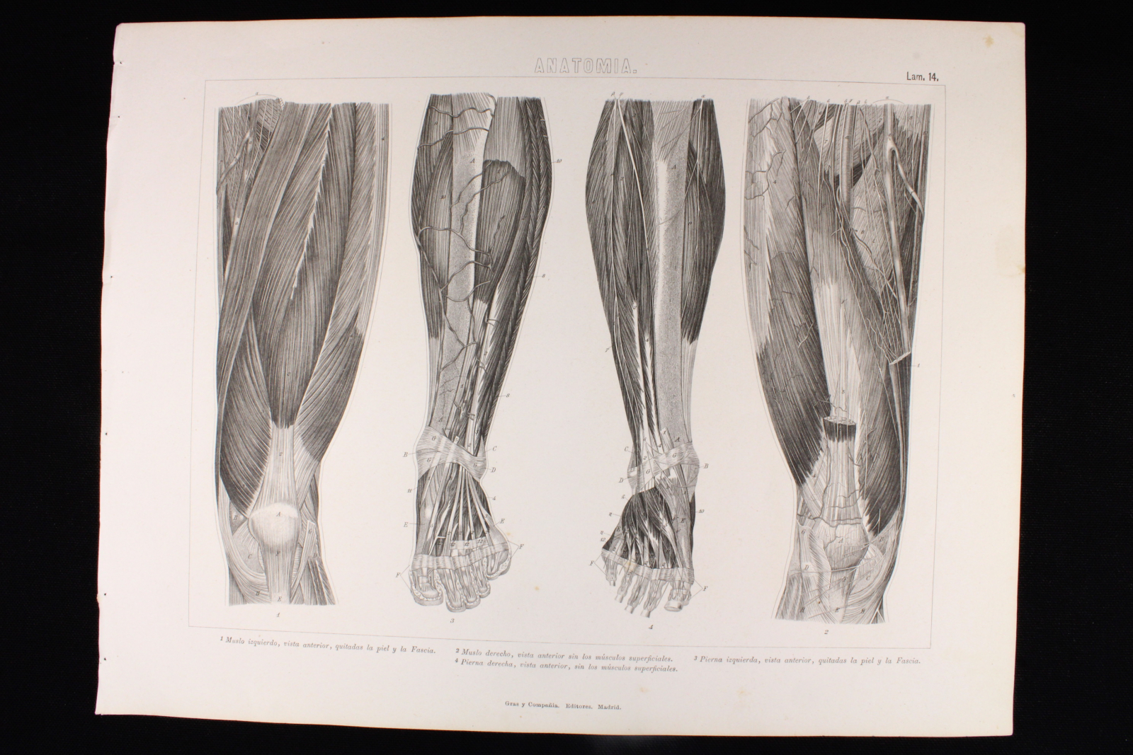 Antiguedades - GRABADO ANATOMÍA LÁMINA 14. GRAS Y Cª. 1885. BRAZO, ANTEBRAZO