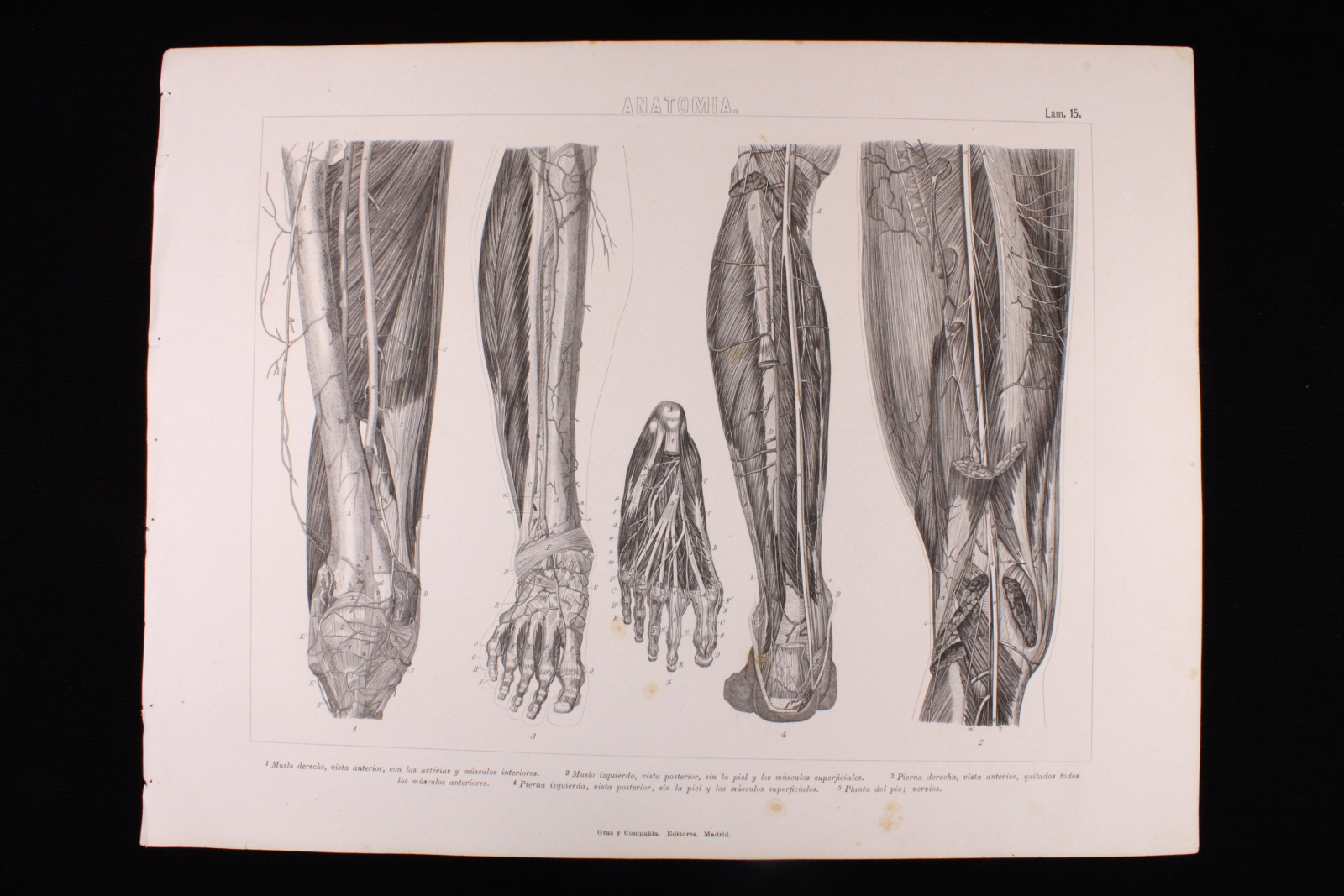 Antiguedades - GRABADO ANATOMÍA LÁMINA 15. GRAS Y Cª. 1885. MUSLOS, PIERNAS Y PLANTA 